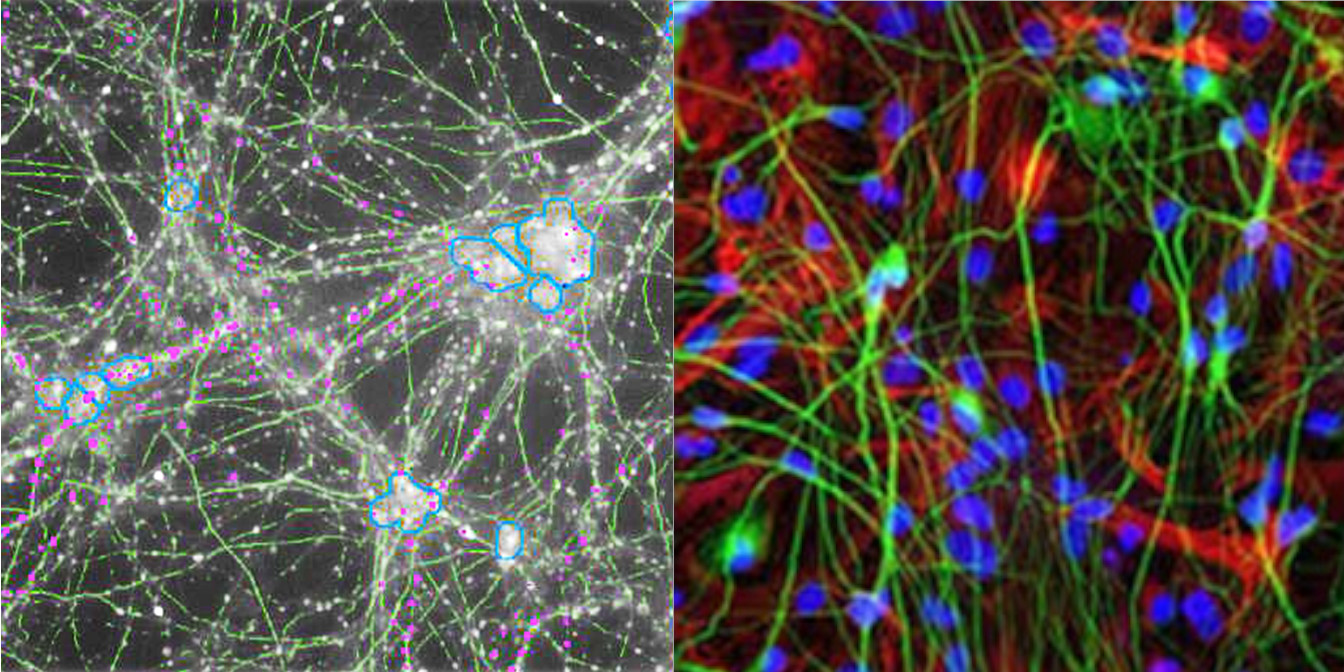 iPSC Disease Models