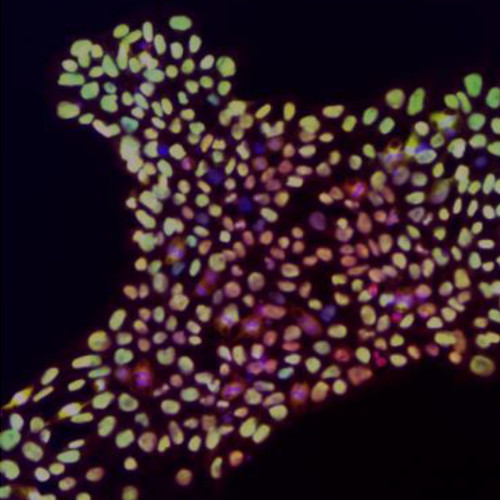 Oct4, Nanog, Sox2, Tra-1-60 expression