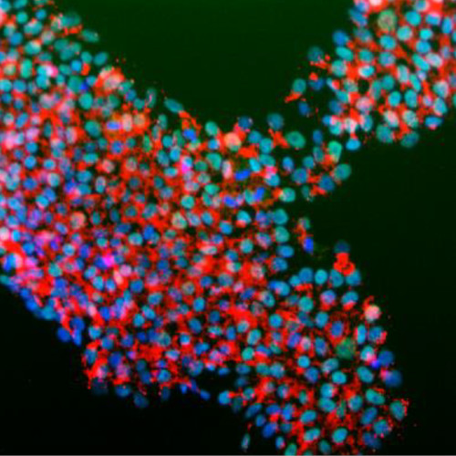 Oct4, Nanog, Sox2, Tra-1-60 expression