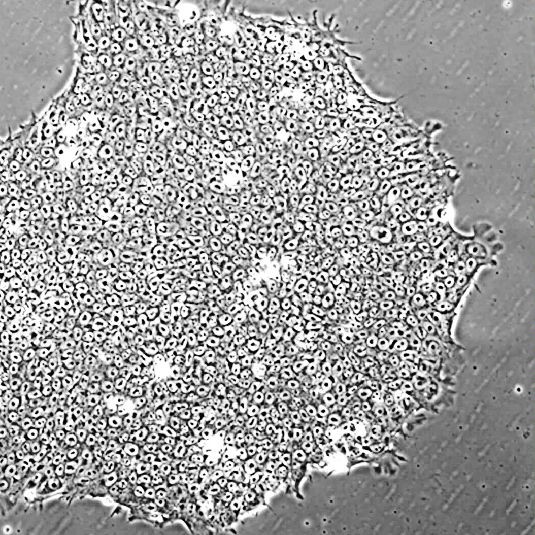 iPSC Disease Models